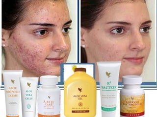 VíctorHugo Ramírez
DistribuidorIndependiente.
Móvil: 3214367474 Colombia.
Email : naturalmenteforever@hotmail.com
Skype: victorh_ramirez
twitter: @vhramirezflp
SISTEMA INMUNE
 