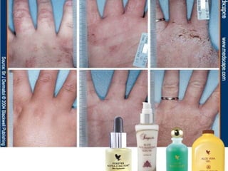 VíctorHugo Ramírez
DistribuidorIndependiente.
Móvil: 3214367474 Colombia.
Email : naturalmenteforever@hotmail.com
Skype: victorh_ramirez
twitter: @vhramirezflp
SISTEMA INMUNE
 