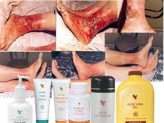 VíctorHugo Ramírez
DistribuidorIndependiente.
Móvil: 3214367474 Colombia.
Email : naturalmenteforever@hotmail.com
Skype: victorh_ramirez
twitter: @vhramirezflp
SISTEMA INMUNE
 