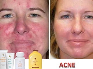 VíctorHugo Ramírez
DistribuidorIndependiente.
Móvil: 3214367474 Colombia.
Email : naturalmenteforever@hotmail.com
Skype: victorh_ramirez
twitter: @vhramirezflp
SISTEMA INMUNE
 