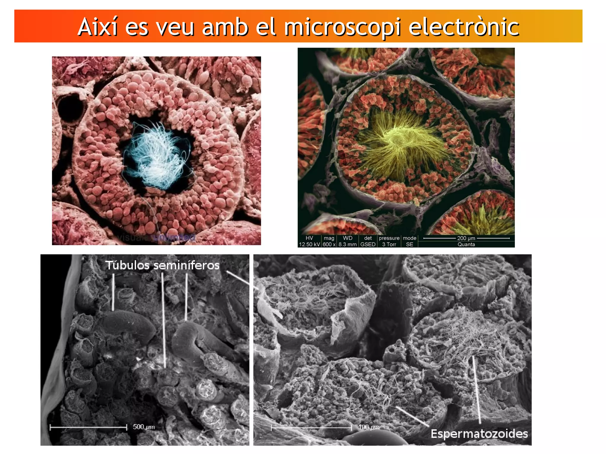 Així es veu amb el microscopi electrònicAixí es veu amb el microscopi electrònic
 