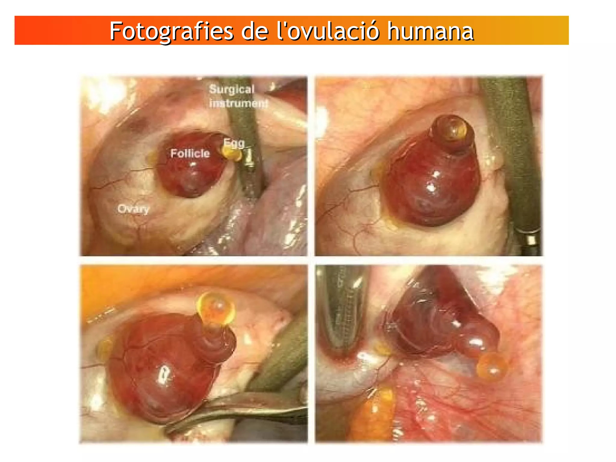 Fotografies de l'ovulació humanaFotografies de l'ovulació humana
Vols veure unes imatges d'un ovari
humà en el moment que el fol·licle
allibera l'òvul?
 