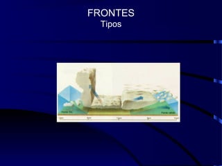 FRONTES
Tipos
 