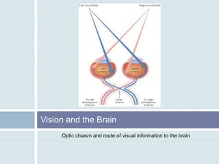 Vision and the Brain
     Optic chiasm and route of visual information to the brain
 