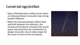COMET TAIL SIGN: The comet tail sign is a finding that can be seen on ...