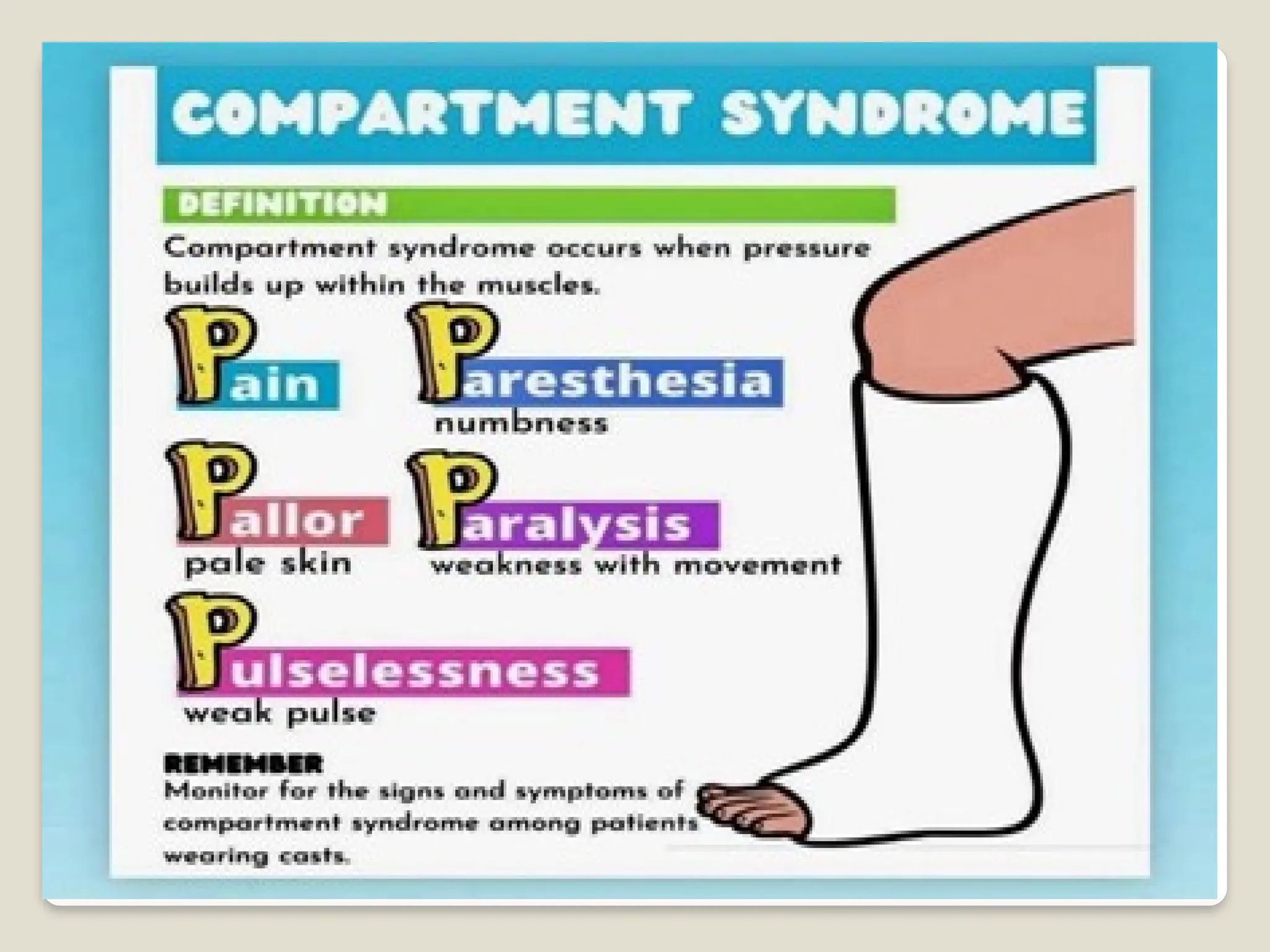 Compartment syndrome, meaning , types, causes , nursing management ...