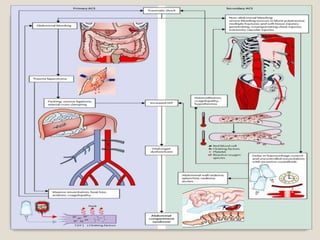 Compartment syndrome, meaning , types, causes , nursing management
