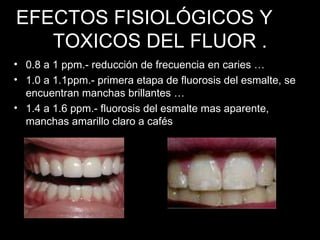 EFECTOS FISIOLÓGICOS Y  TOXICOS DEL FLUOR . 0.8 a 1 ppm.- reducción de frecuencia en caries … 1.0 a 1.1ppm.- primera etapa de fluorosis del esmalte, se encuentran manchas brillantes … 1.4 a 1.6 ppm.- fluorosis del esmalte mas aparente, manchas amarillo claro a cafés 