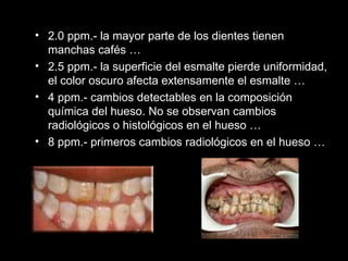 2.0 ppm.- la mayor parte de los dientes tienen manchas cafés … 2.5 ppm.- la superficie del esmalte pierde uniformidad, el color oscuro afecta extensamente el esmalte … 4 ppm.- cambios detectables en la composición química del hueso. No se observan cambios radiológicos o histológicos en el hueso … 8 ppm.- primeros cambios radiológicos en el hueso … 