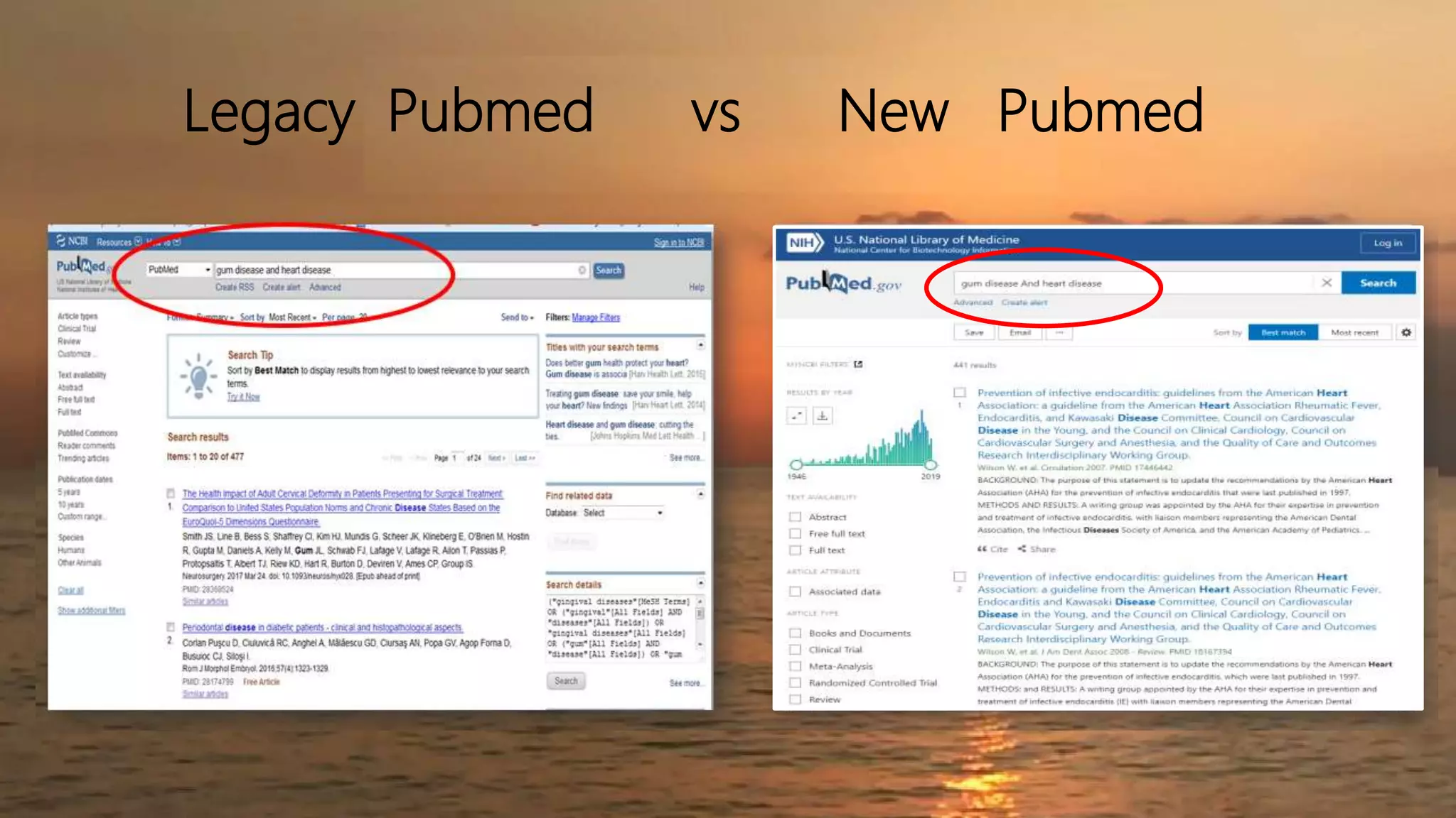 Legacy Pubmed vs New Pubmed
 