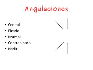 Angulaciones

Cenital

Picado

Normal

Contrapicado

Nadir
 