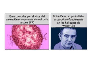 Eran causados por el virus del    Brian Deer, el periodista,
sarampión (componente normal de la    escarbó profundamente
 ...