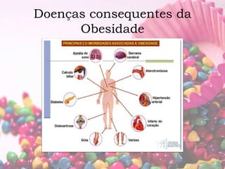 Doenças consequentes da 
Obesidade 
 