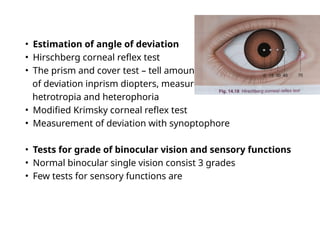 Comitant strabismus.ophthalmology.squint.pptx | Eye and Vision ...