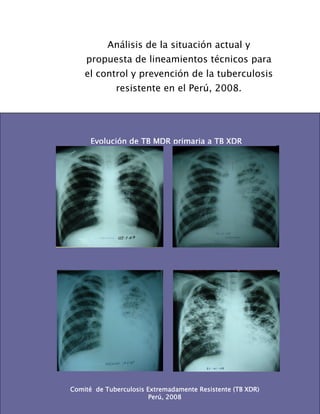 Análisis de la situación actual y
    propuesta de lineamientos técnicos para
    el control y prevención de la tuberculosis
             resistente en el Perú, 2008.




      Evolución de TB MDR primaria a TB XDR




Comité de Tuberculosis Extremadamente Resistente (TB XDR) -
                                                       -I
                        Perú, 2008
 