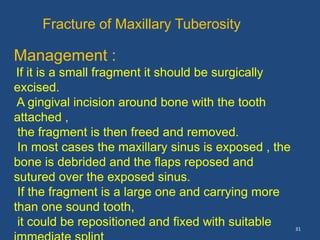 31
Management :
If it is a small fragment it should be surgically
excised.
A gingival incision around bone with the tooth
attached ,
the fragment is then freed and removed.
In most cases the maxillary sinus is exposed , the
bone is debrided and the flaps reposed and
sutured over the exposed sinus.
If the fragment is a large one and carrying more
than one sound tooth,
it could be repositioned and fixed with suitable
Fracture of Maxillary Tuberosity
 