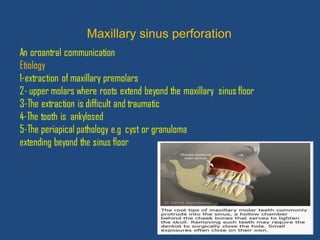 32
Maxillary sinus perforation
 