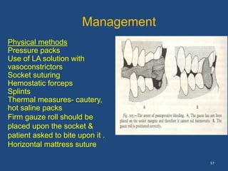 57
Physical methods
Pressure packs
Use of LA solution with
vasoconstrictors
Socket suturing
Hemostatic forceps
Splints
Thermal measures- cautery,
hot saline packs
Firm gauze roll should be
placed upon the socket &
patient asked to bite upon it .
Horizontal mattress suture
Management
 