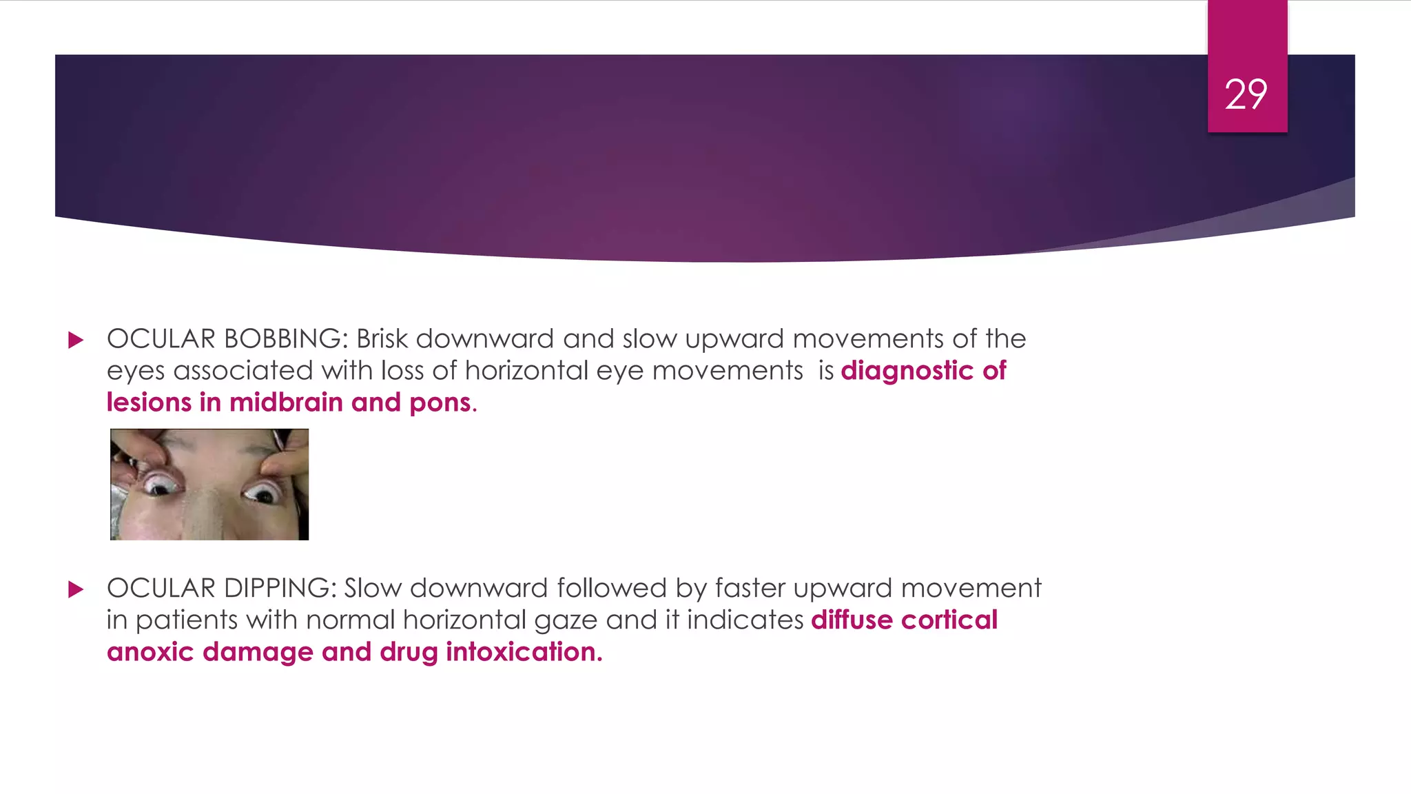  OCULAR BOBBING: Brisk downward and slow upward movements of the
eyes associated with loss of horizontal eye movements is diagnostic of
lesions in midbrain and pons.
 OCULAR DIPPING: Slow downward followed by faster upward movement
in patients with normal horizontal gaze and it indicates diffuse cortical
anoxic damage and drug intoxication.
29
 