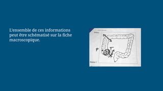 L’ensemble de ces informations
peut être schématisé sur la fiche
macroscopique.
 