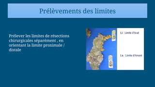 Prélèvements des limites
Prélever les limites de résections
chirurgicales séparément , en
orientant la limite proximale /
distale
 