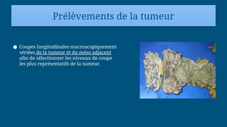 Prélèvements de la tumeur
● Coupes longitudinales macroscopiquement
sériées de la tumeur et du méso adjacent
afin de sélectionner les niveaux de coupe
les plus représentatifs de la tumeur.
 