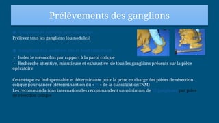 Prélèvements des ganglions
● Ganglions et nodules peri tumoraux :
Prélever tous les ganglions (ou nodules)
● Ganglions (ou nodules) sus et sous tumoraux :
- Isoler le mésocolon par rapport à la paroi colique
- Recherche attentive, minutieuse et exhaustive de tous les ganglions présents sur la pièce
opératoire
Cette étape est indispensable et déterminante pour la prise en charge des pièces de résection
colique pour cancer (déterminantion du « N » de la classificationTNM)
Les recommandations internationales recommandent un minimum de 12 ganglions par pièce
de résection colique
 