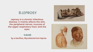 Leprosy is a chronic infectious
disease. It mainly affects the skin,
the peripheral nerves, mucosa of
the upper respiratory tract, and the
eyes.
8.LEPROSY
CAUSE
by a bacillus, Mycobacterium leprae
 
