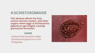 This disease affects the liver,
central nervous system, and other
organs where eggs of Schistosoma
japonicum get lodged, causing
granuloma formation.
4.SCHISTOSOMIASIS
CAUSE
A blood fluke (parasite) called
Schistosoma japonicum in the
Philippines
 