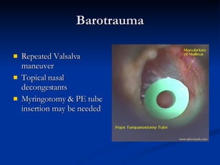 Barotrauma Repeated Valsalva maneuver Topical nasal decongestants Myringotomy & PE tube insertion may be needed 