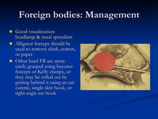 Foreign bodies: Management Good visualization: headlamp & nasal speculum Alligator forceps should be used to remove cloth, cotton, or paper  Other hard FB are more easily grasped using bayonet forceps or Kelly clamps, or they may be rolled out by getting behind it using an ear curette, single skin hook, or right angle ear hook   