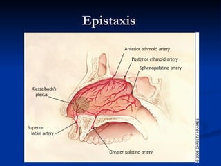 Epistaxis  