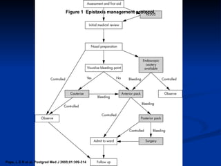 Pope, L E R et al. Postgrad Med J 2005;81:309-314 Figure 1  Epistaxis management protocol. 