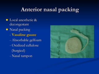 Anterior nasal packing Local anesthetic & decongestant  Nasal packing -  Vasaline guaze - Absorbable gelfoam - Oxidized cellulose (Surgicel)  - Nasal tampon 