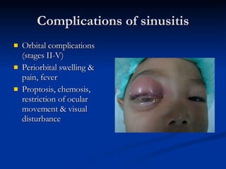 Complications of sinusitis Orbital complications (stages II-V) Periorbital swelling & pain, fever Proptosis, chemosis, restriction of ocular movement & visual disturbance 