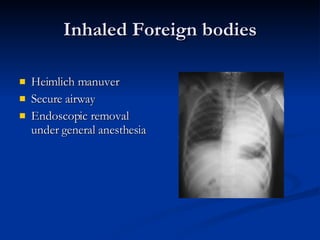 Inhaled Foreign bodies Heimlich manuver Secure airway  Endoscopic removal under general anesthesia 