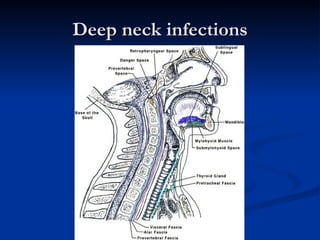 Deep neck infections 