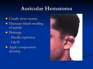 Auricular Hematoma Usually from trauma Fluctuant bluish swelling of auricle Drainage - Needle aspiration - I & D Apply compression dressing 