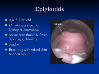 Epiglottitis Age 3-7 yrs old H. influenzae  type B, Group A  Streptococcus  severe sore throat & fever, dysphagia, drooling  Stridor Breathing with raised chin & open mouth 