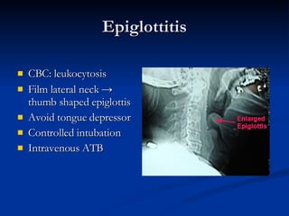 Epiglottitis CBC: leukocytosis Film lateral neck  ->  thumb shaped epiglottis Avoid tongue depressor Controlled intubation Intravenous ATB 