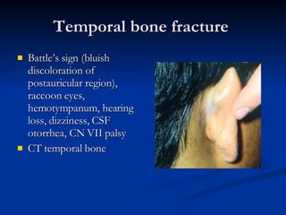 Temporal bone fracture  Battle’s sign (bluish discoloration of postauricular region), raccoon eyes, hemotympanum, hearing loss, dizziness, CSF otorrhea, CN VII palsy CT temporal bone 