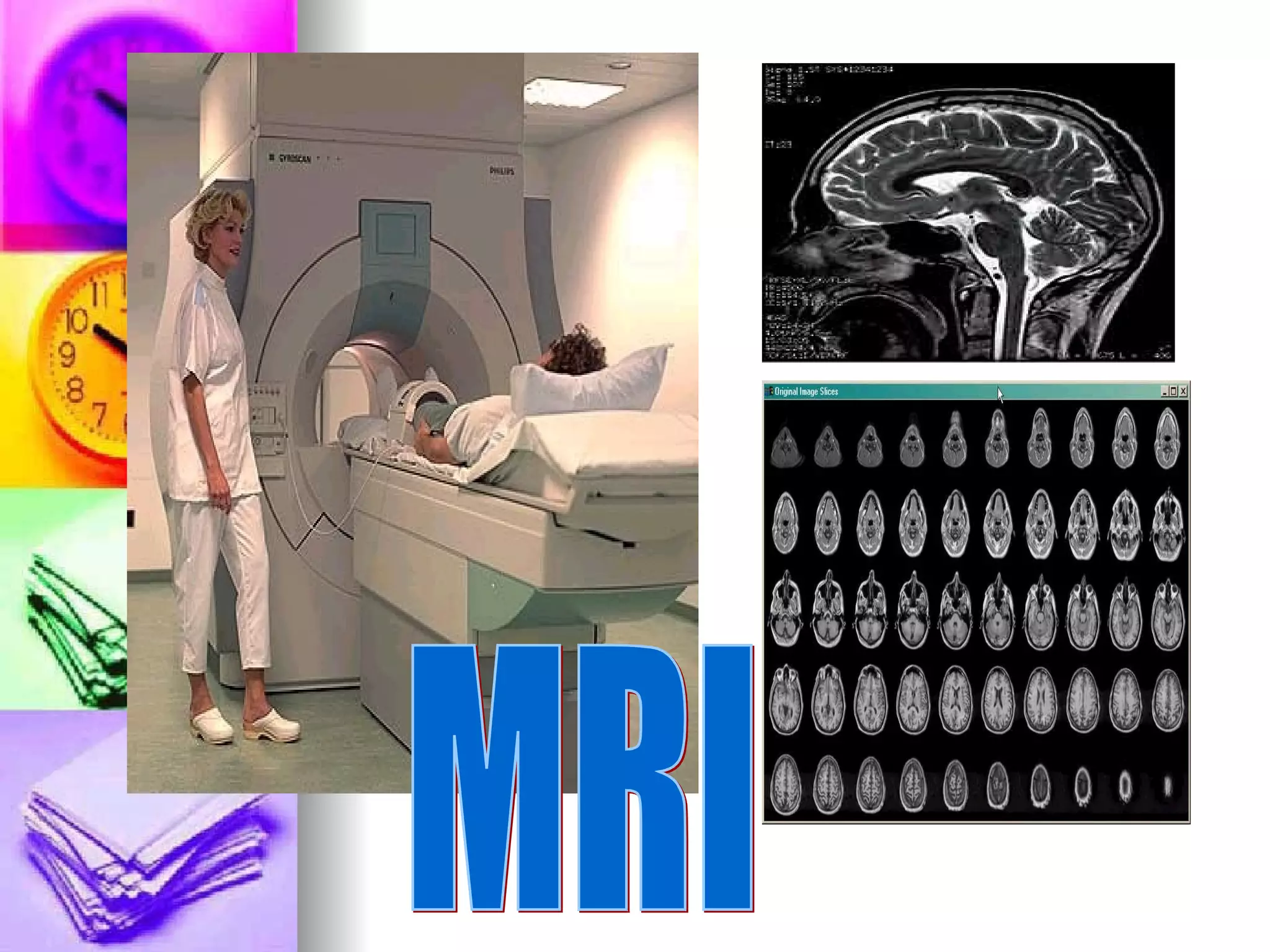 MRI 