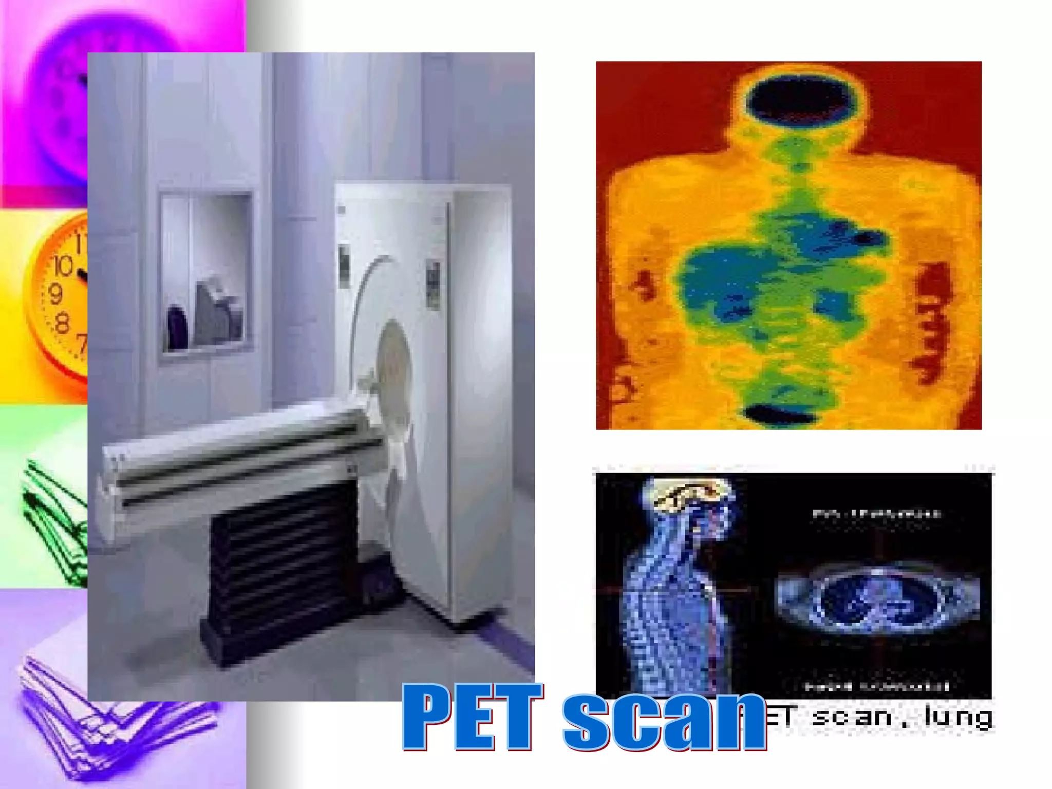 PET scan 
