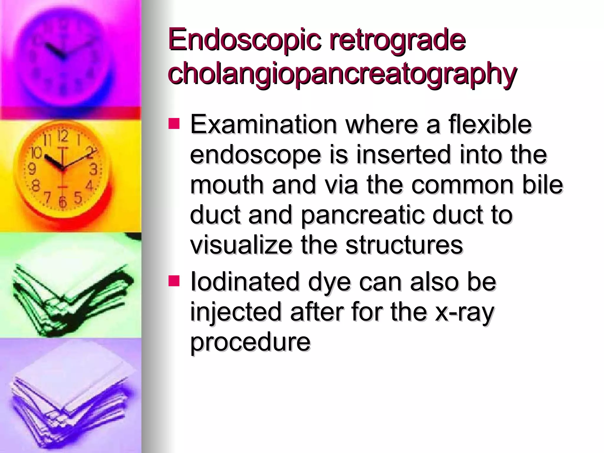 Endoscopic retrograde cholangiopancreatography Examination where a flexible endoscope is inserted into the mouth and via the common bile duct and pancreatic duct to visualize the structures Iodinated dye can also be injected after for the x-ray procedure 