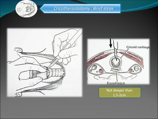 Not deeper than  1.5-2cm. 