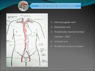 Internal jugular vein Subclavian vein Peripherally Inserted Central Catheter : PICC  Femoral vein Peripheral venous cut down 