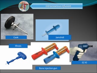 Cook  Jamshidi Illinois Bone injection gun EZ IO 
