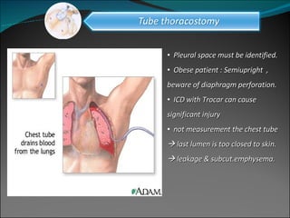 Pleural space must be identified. Obese patient : Semiupright  , beware of diaphragm perforation. ICD with Trocar can cause significant injury not measurement the chest tube    last lumen is too closed to skin.    leakage & subcut.emphysema.  