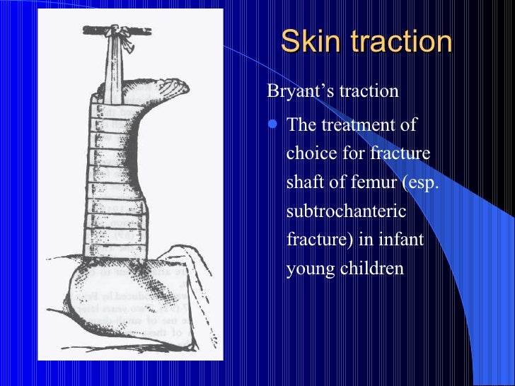 Common pitfalls in orthopedics