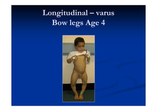pedactric genital exam of child common-problems-in-children-s-orthopaedics-gp-mr-uglow.pdf
